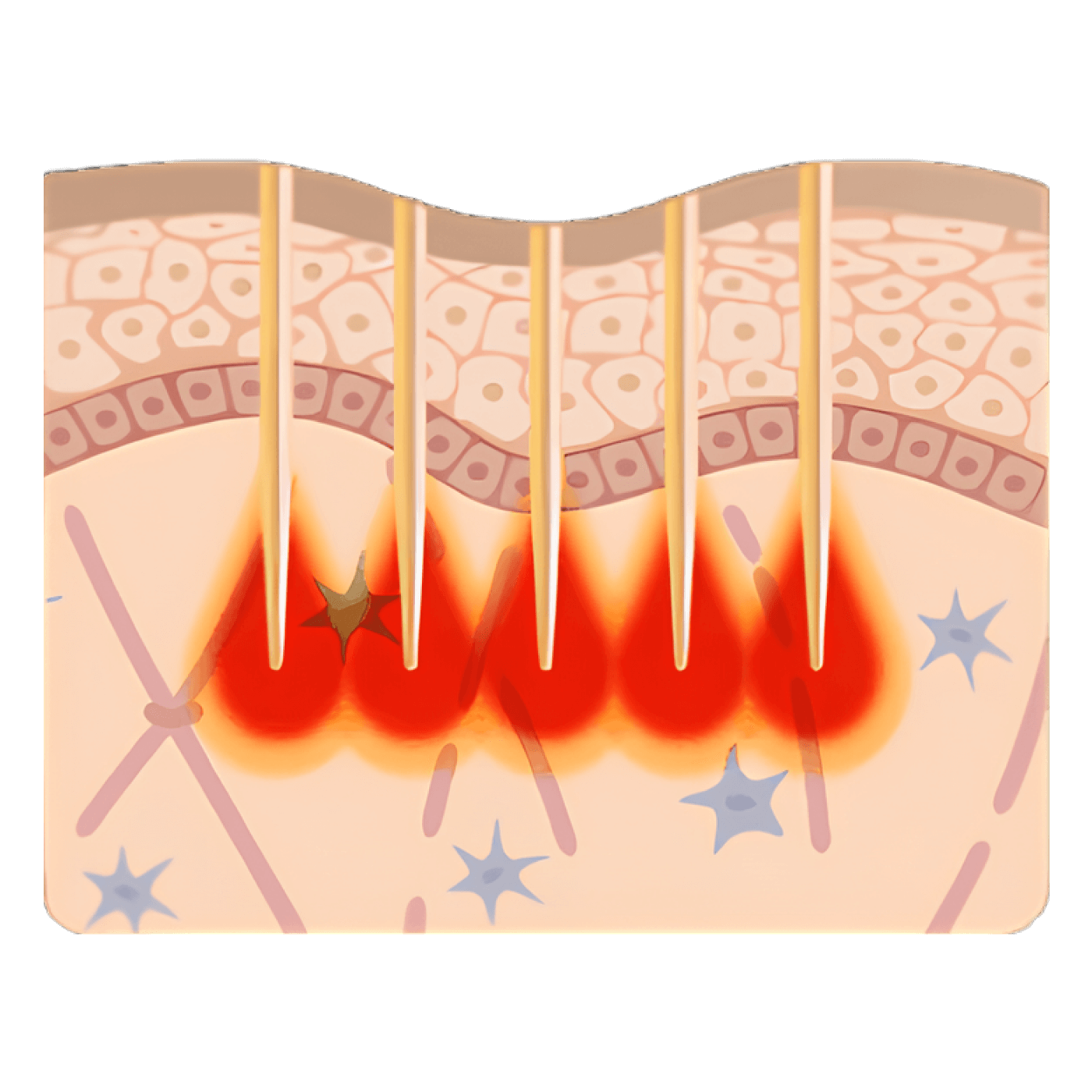Длительный импульс (СиВи) 