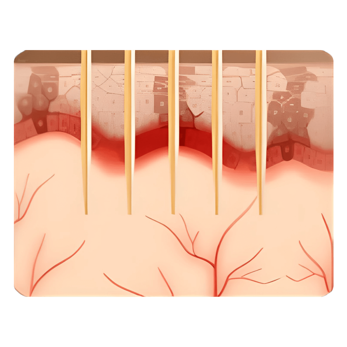 Дробный импульс (ПиВи)