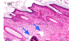 Технология оптического лазерного пробоя